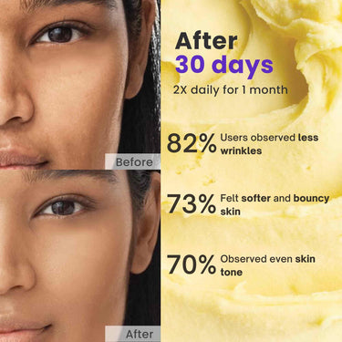 SAFFR'N Anti Ageing Cream With 5% Resveratrol,5% Argireline,10% Hyaluronic Acid,Collagen,Vitamin E,Bakuchiol,Saffron,Centella&Olive Stem Cell Extracts,&Nano Tech To Reduce Ageing Signs|50 Ml